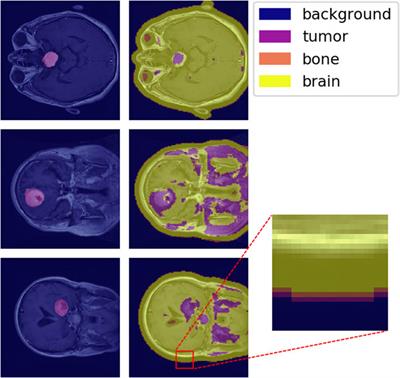 Learning Medical Materials From Radiography Images